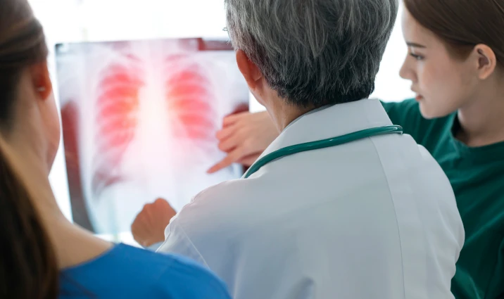 Medical doctor/instructor reviewing chest x-ray with students
